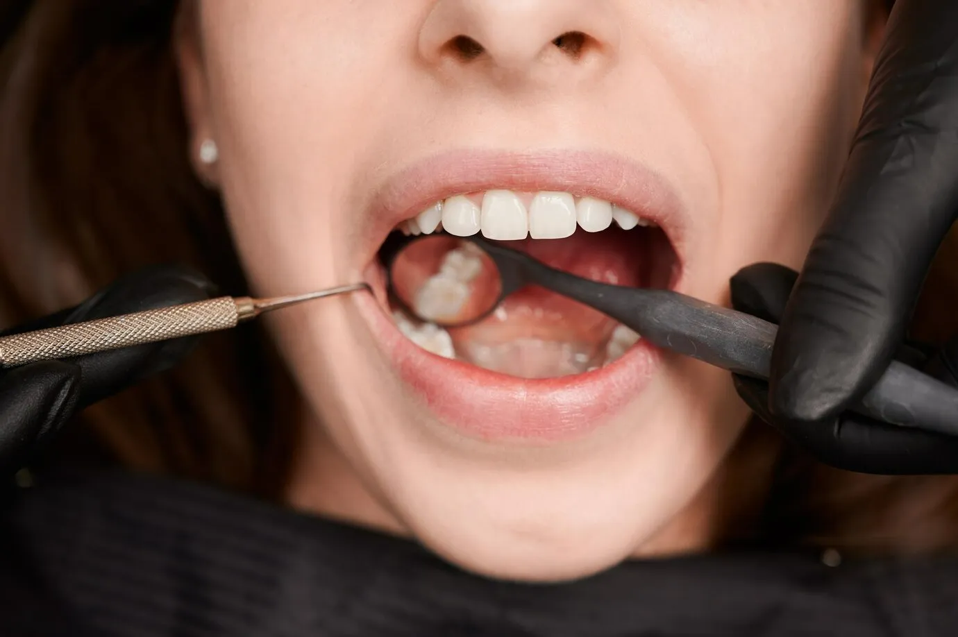 Kaip tinkamai prižiūrėti dantis