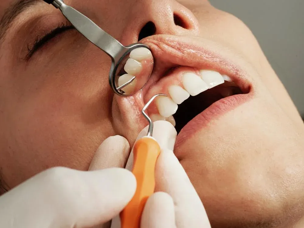 Ar įmanoma grąžinti dantų baltumą