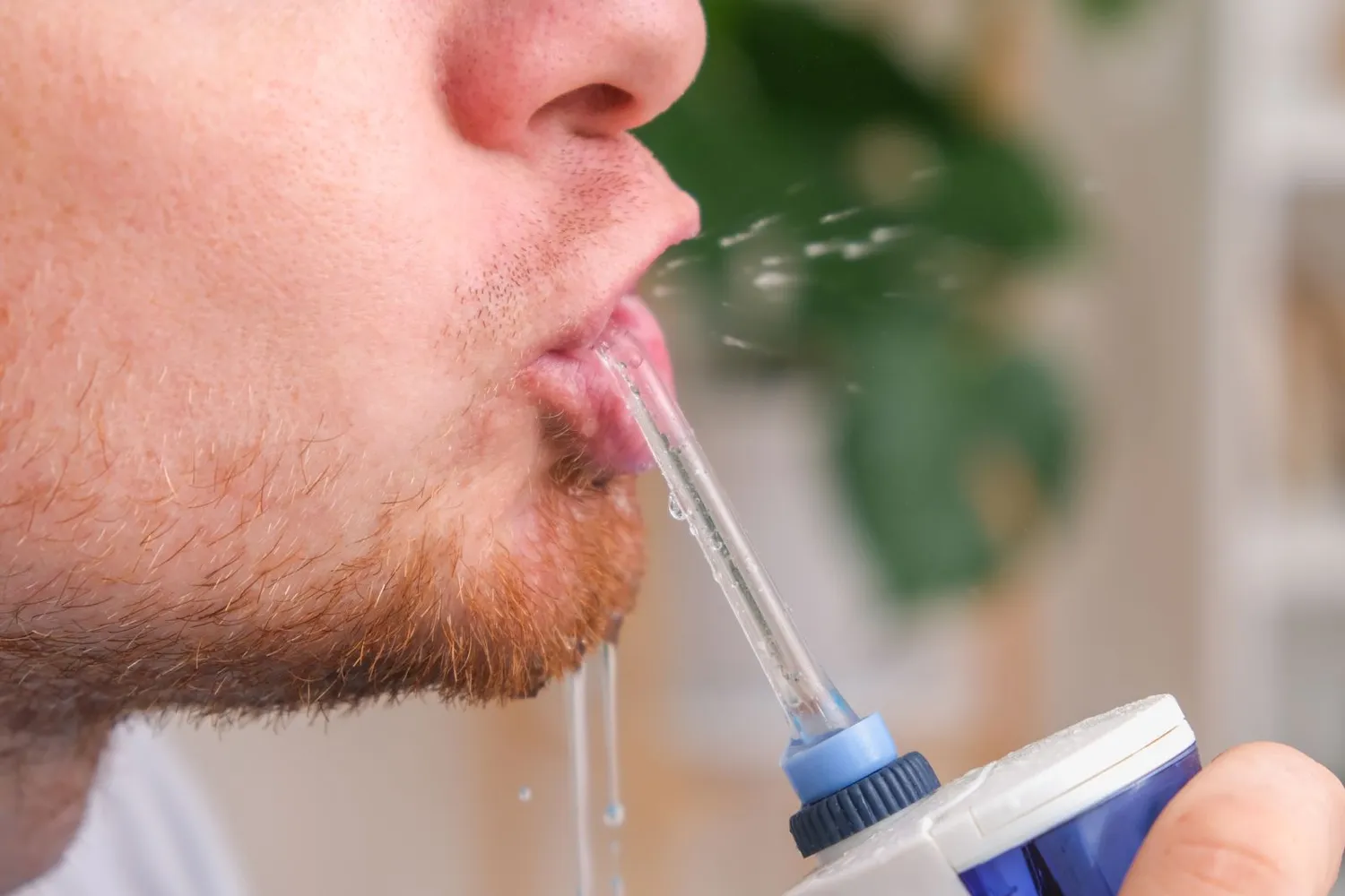 Irigatoriaus naudojimas