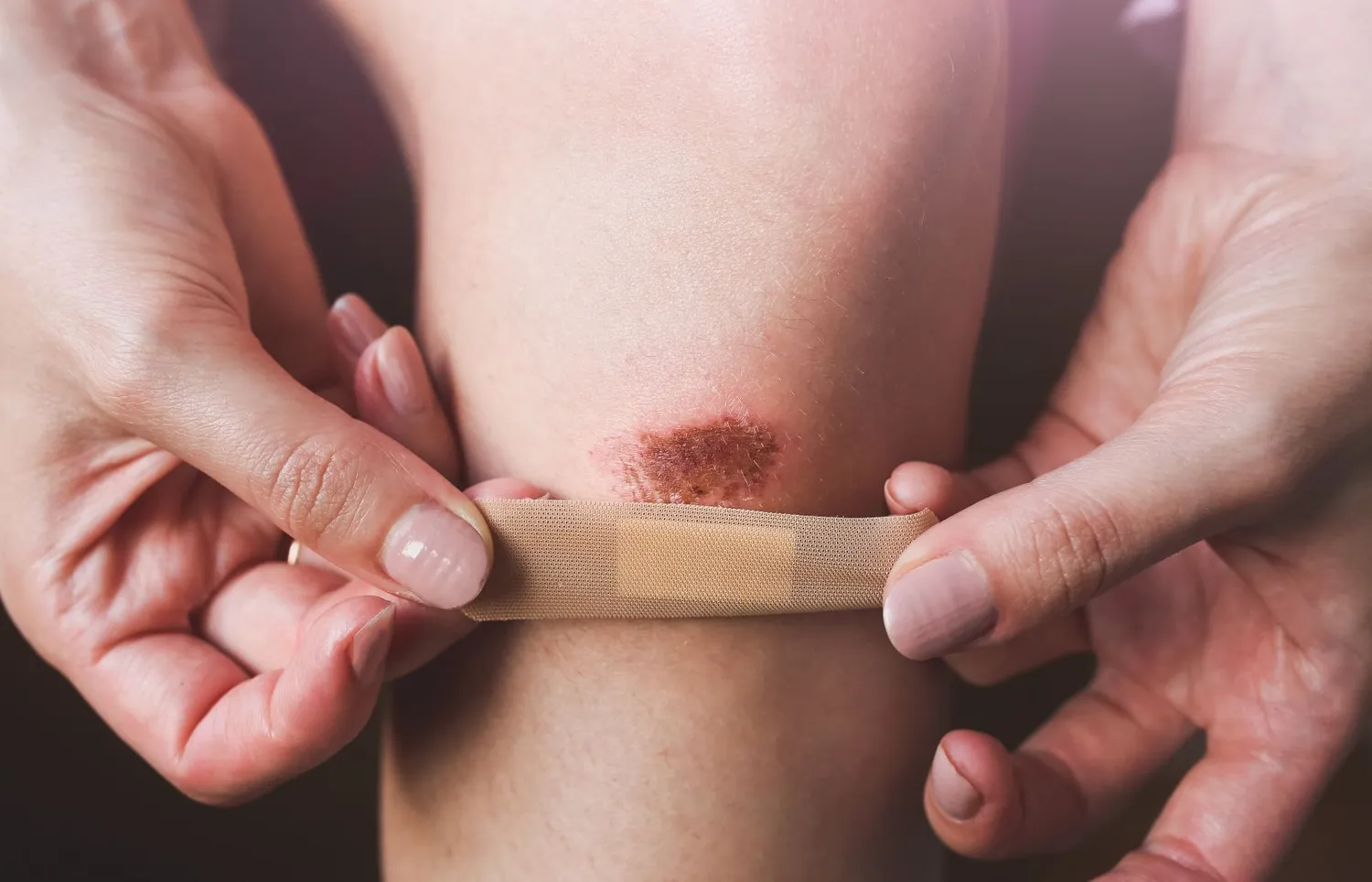 Žaizda ir pleistras